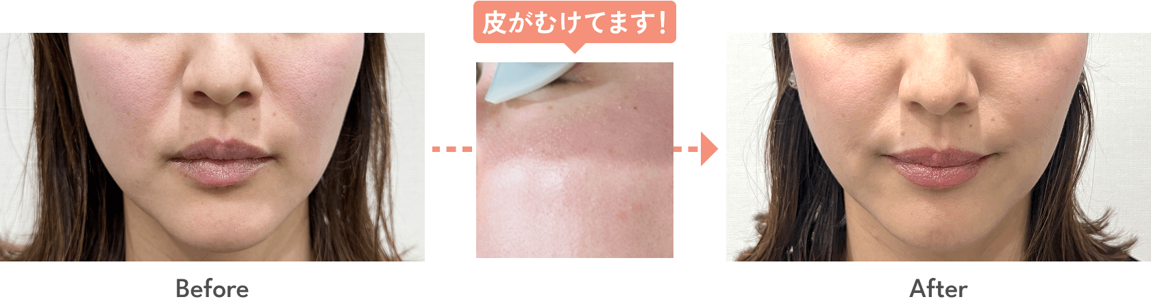 治療の経過
